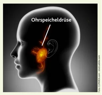 tumor in der ohrspeicheldruse thumbnail-hno21