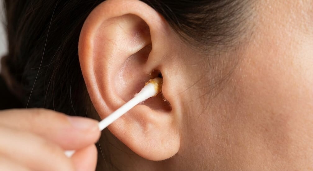 Ohrenschmalz Risiko-hno21
