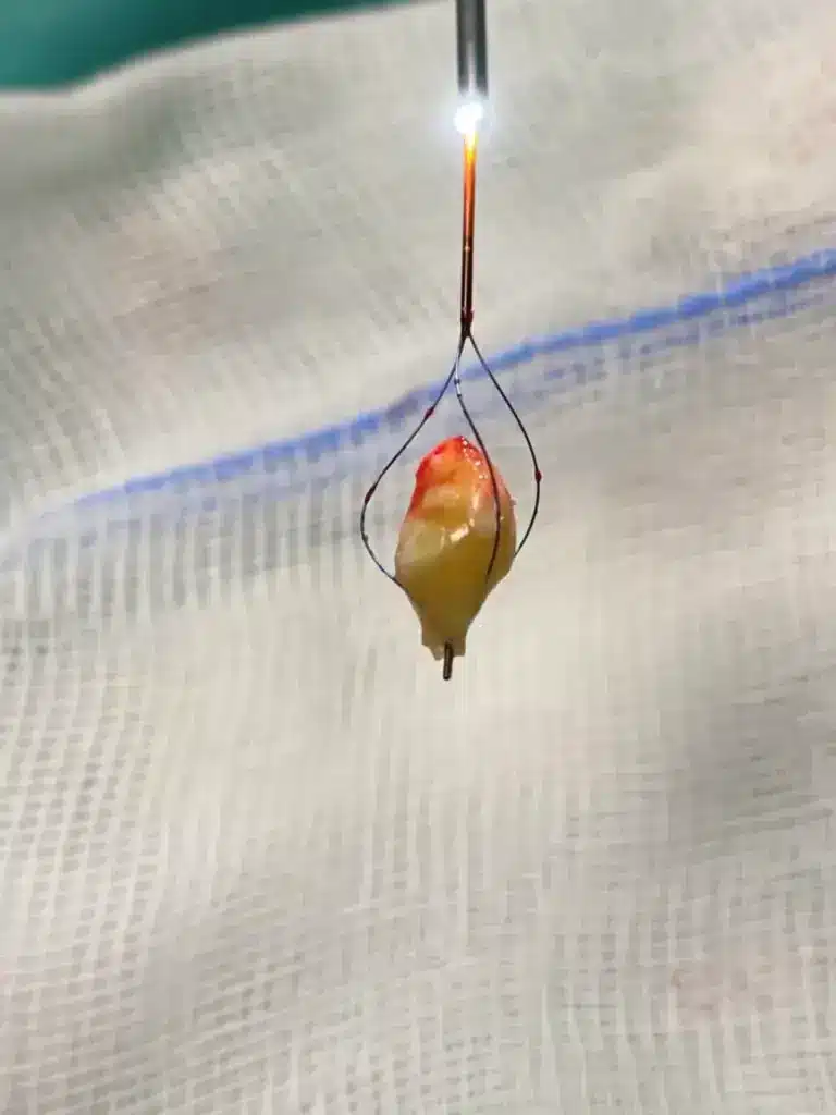 sialendo1 768x1024 1-hno21